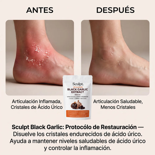 Sculpt Black Garlic Protocólo de Restauración